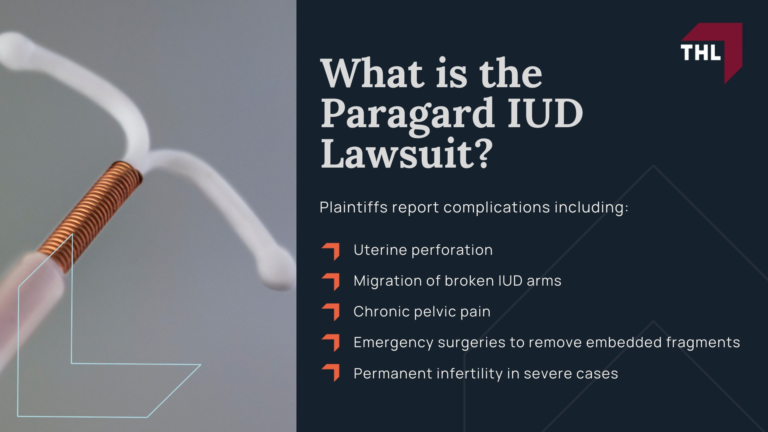 Can You Still File a Paragard Lawsuit in 2026?