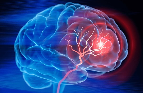 Long-Term Consequences of Brain Injury and the Compensation You Can Get