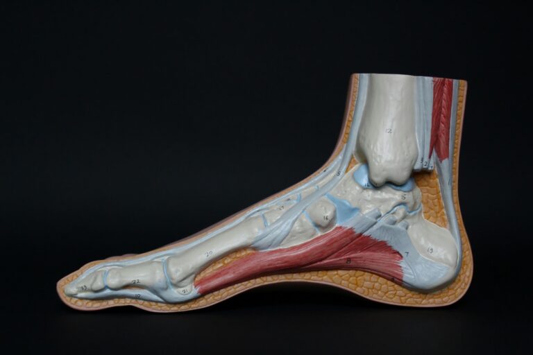 When Can You Claim Compensation for an Ankle Injury?